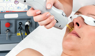 Laser treatments